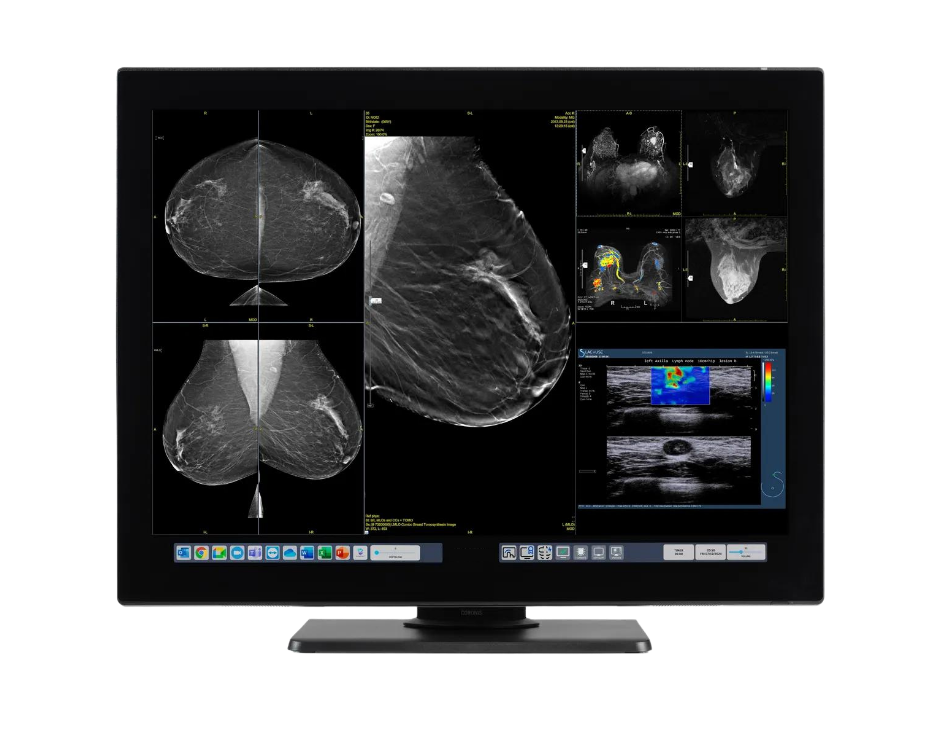 monitores-para-radiologia