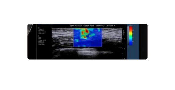 pantallas-para-radiología