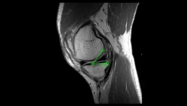 Medición de ángulos