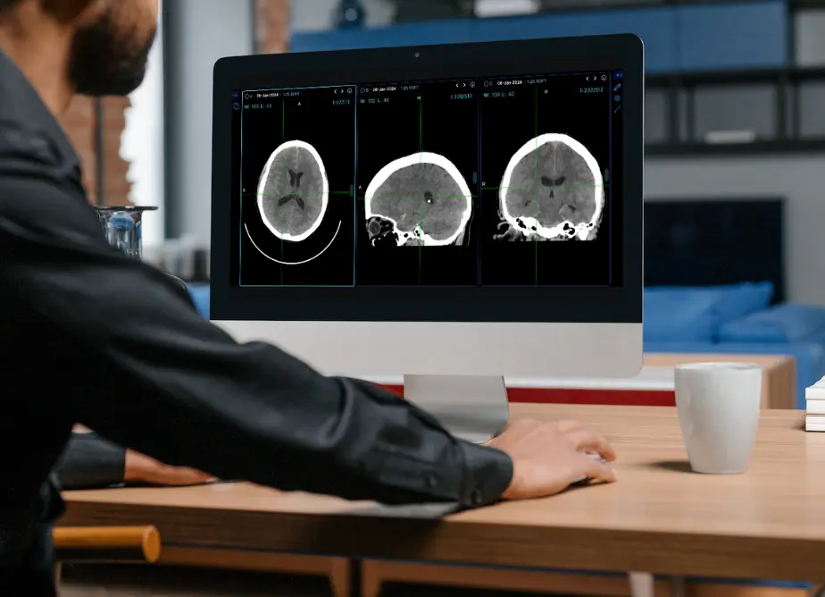 Qué es Teleradiología y para qué sirve en un hospital